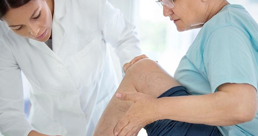Varicose veins are observed in every second person