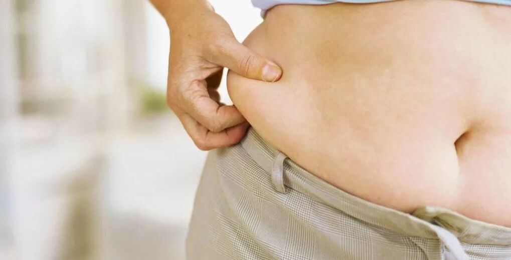 Excess weight and varicose