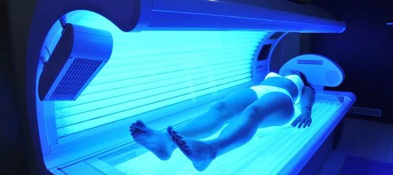 Varicose veins and solarium