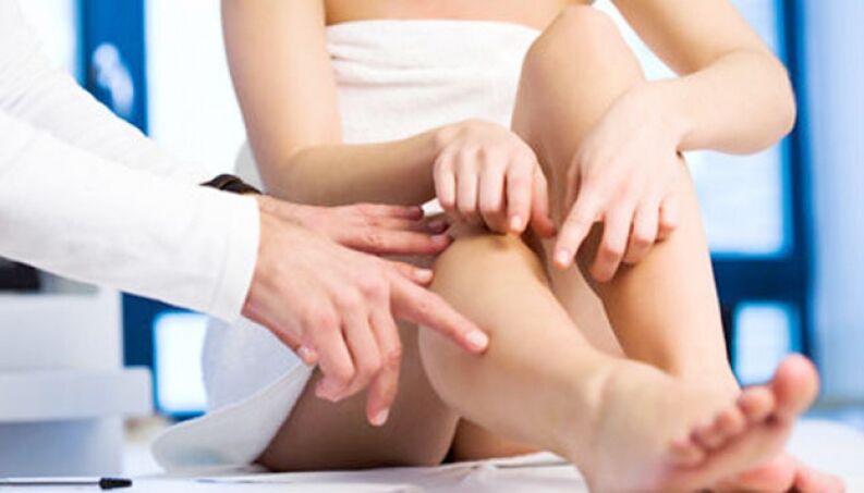 woman with problematic leg veins at a doctor's appointment